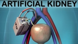 UCSF Artificial Kidney Medical Animation